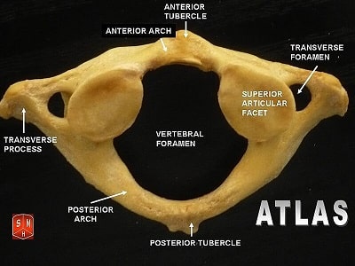 Vértebra atlas
