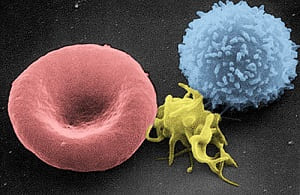 Células sanguíneas: glóbulo rojo, plaqueta y glóbulo blanco