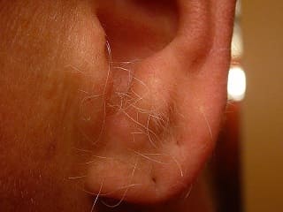 Tener pelos en las orejas es un caracter que se pasa de padres a hijos a través del cromosoma Y